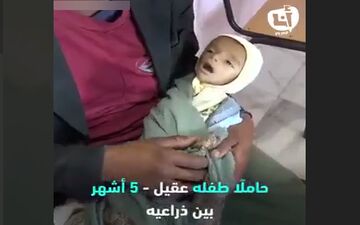 لحظاتی دردناک از تلاش پدر یمنی برای نجات جان کودک شیرخواره‌اش +فیلم 