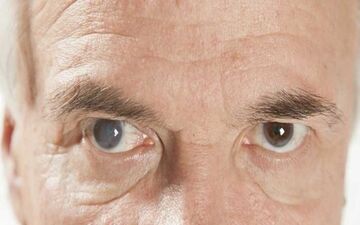 نزدیک بینی بهتر است یا دوربینی؟