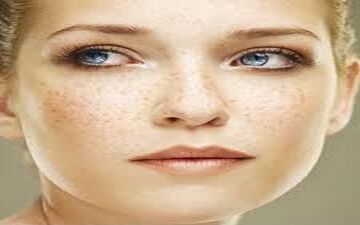 
بهترین راه مقابله با کک و مک صورت
