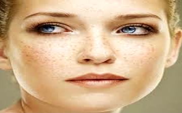 
بهترین راه مقابله با کک و مک صورت
