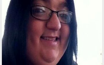 درخواست غرامت یک دختر بابت زشتی چهره 