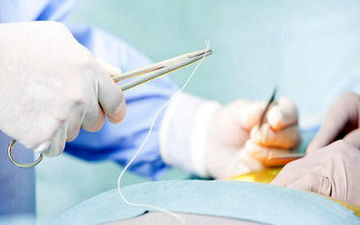 مهم‌ترین علل مرگ زنان ایرانی/تشریح بسته خدمتی وزارت بهداشت
