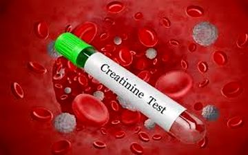 آزمایش کراتین خون چیست و در چه مواردی باید انجام شود؟