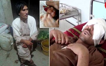 عشق پسر22 ساله کار دستش داد/ پدر با «قاشق» چشمان پسرش را از حدقه در آورد + عکس 14+ 