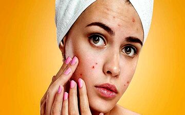 لک پوستی دارید؟ این اقدامات را انجام دهید و این مکمل ها را بخورید