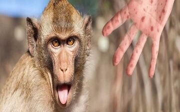 
جهش غیر عادی و سریع ویروس آبله میمونی 