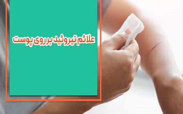 علائم تیروئید بر روی پوست چیست؟