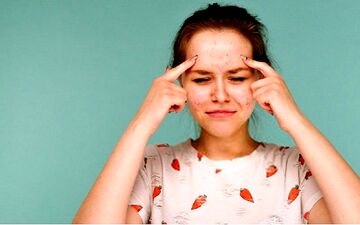 چرا آکنه و جوش در تابستان بیشتر می‌شود؟
