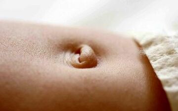 فتق ناف چه زمانی برطرف می شود؟