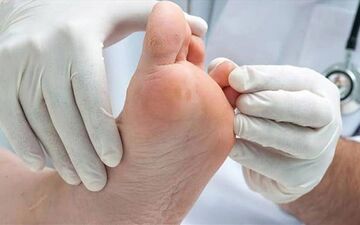 پژوهشگران دلیل بهبود نیافتن زخم‌ها را در ژن این موها پیدا کردند