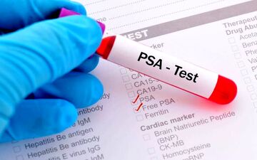 افزایش PSA همیشه به علت سرطان پروستات نیست