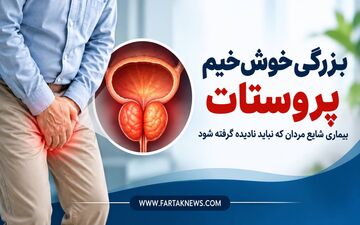 بزرگی خوش‌خیم پروستات؛ بیماری شایع مردان که نباید نادیده گرفته شود
