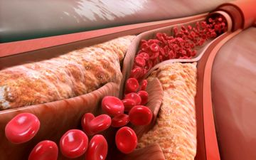 نسخه بی نظیر طب سنتی برای کاهش کلسترول خون